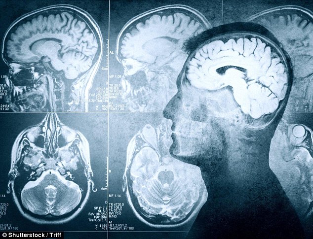 Co se děje v mozku těsně před smrtí?