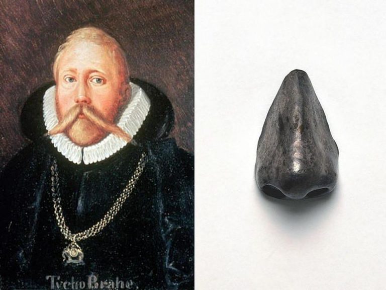 Brahe musel kvůli zranění z mládí nosit bronzovou protézu nosu.