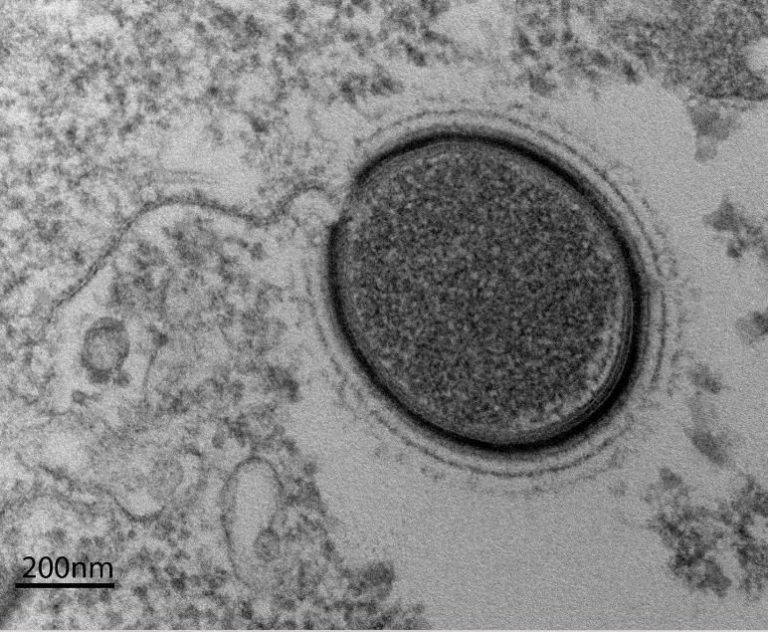 Takto vypadá prehistorický virus pod mikroskopem.