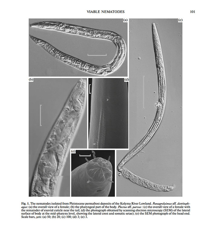 Hlístice pod mikroskopem. Foto: siberiantimes.com