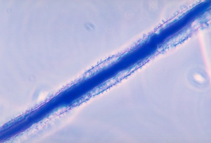 Aspergillus flavus, foto Wikimedia Commons