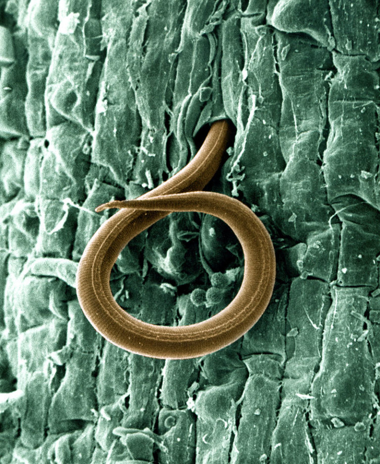Hlístice pod mikroskopem, foto Wikimedia Commons