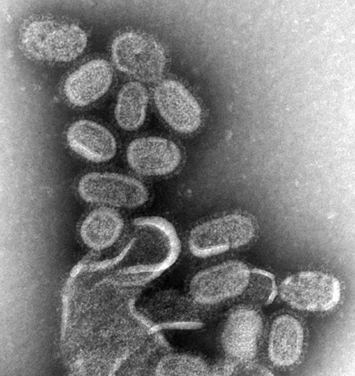 Virus chřipky pod mikroskopem, foto Wikimedia Commons