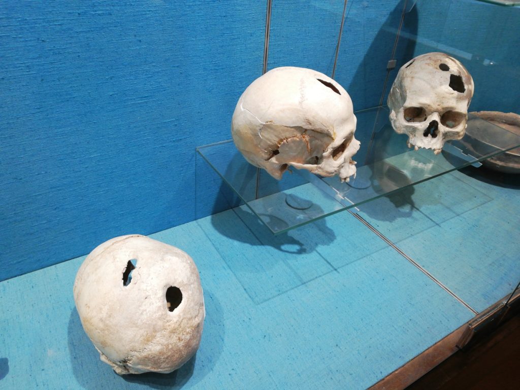 Lebky po trepanaci vystavené ve francouzském muzeu, foto Wikimedia Commons