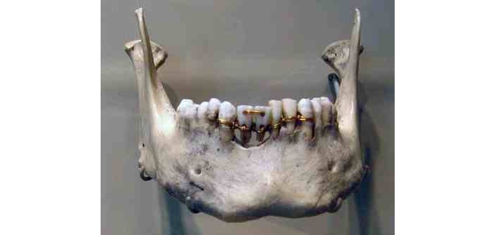 Dílo starověkého egyptského zubaře, foto Ashashyou / Creative Commons / volné dílo