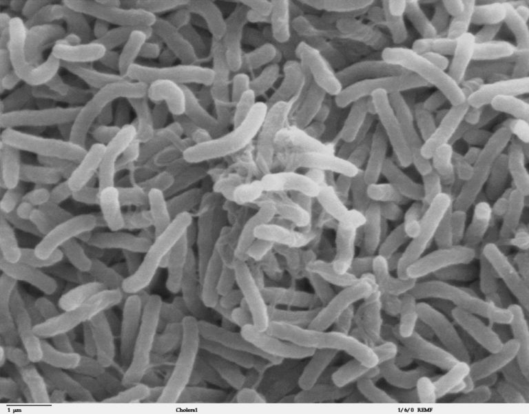 Za smrt básníka jsou pravděpodobně odpovědné bakterie cholery. Zdroj foto: Public domain, via Wikimedia Commons