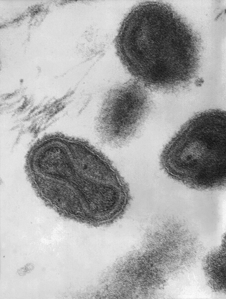 Virus variola pod mikroskopem, foto Dr. Fred Murphy; Sylvia Whitfield / Creative Commons / Volné dílo