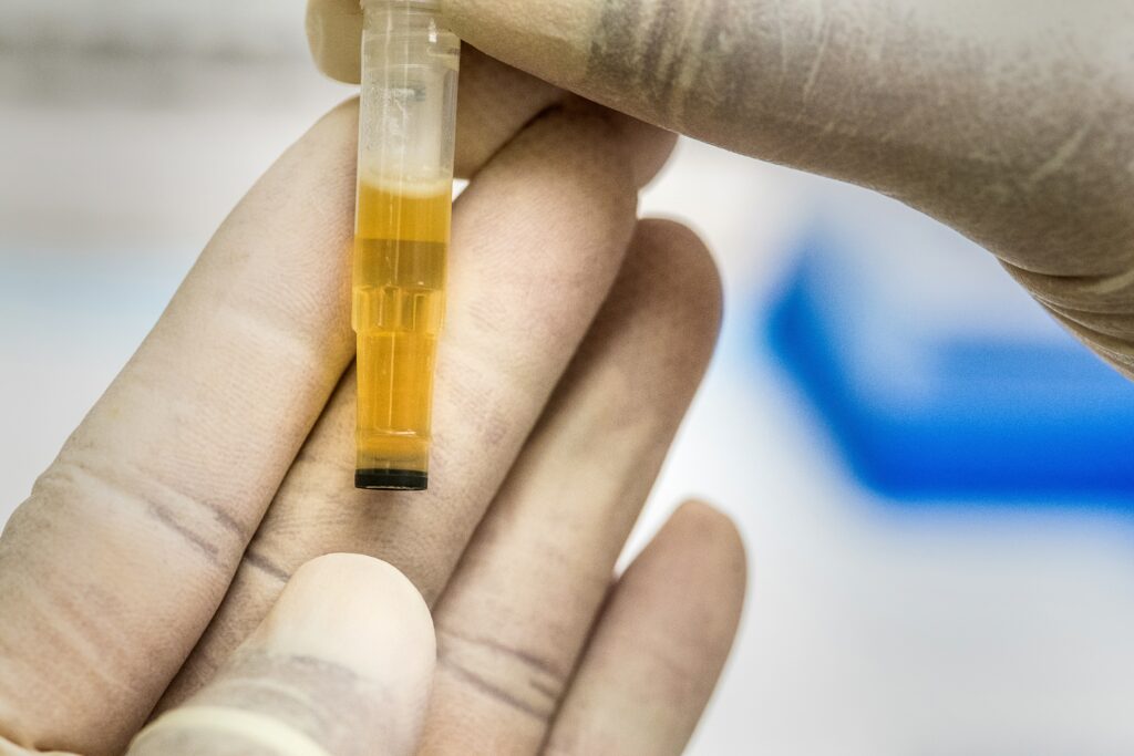 Podle teorií příznivců urinoterapie může moč „zalarmovat“ organismus, který je postižen nějakou nemocí. Foto: UnSplash