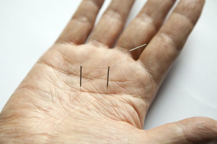 Odborníci na akupunkturu upozorňují, že navzdory stereotypním představám, proces terapie vůbec nebolí. Foto: National Institute of Korean Language / CC BY-SA 2.0 kr