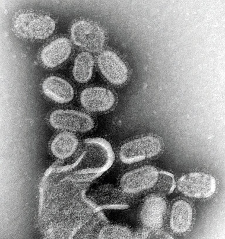 Umřel Dr. Robert Leslie Burghoff kvůli virusu chřipky?