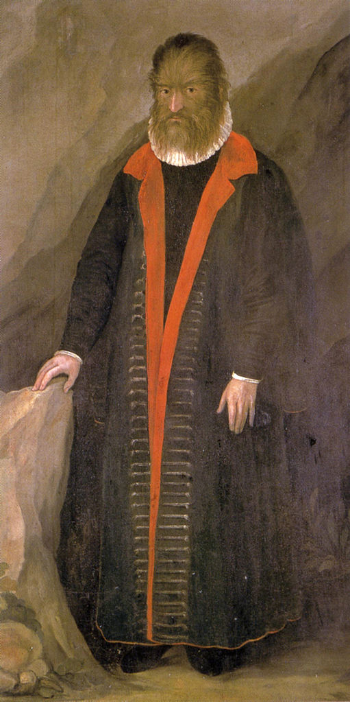 Pedro González byl nazýván “lesním mužem”. Zdroj obrázku: Ambras Castle, Public domain, via Wikimedia Commons