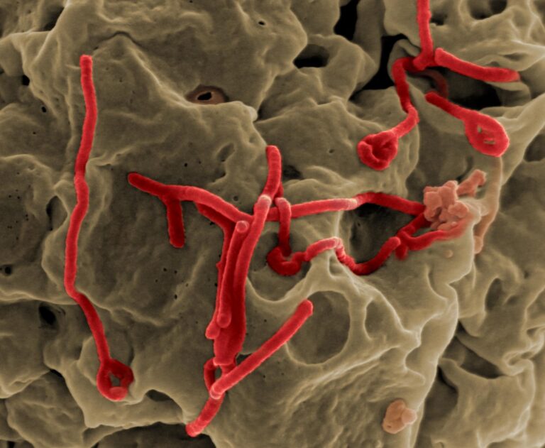 Virus eboly je jedním z nejhorších, který může být. Foto: NIAID – Ebola Virus, CC BY 2.0, Wikimedia commons