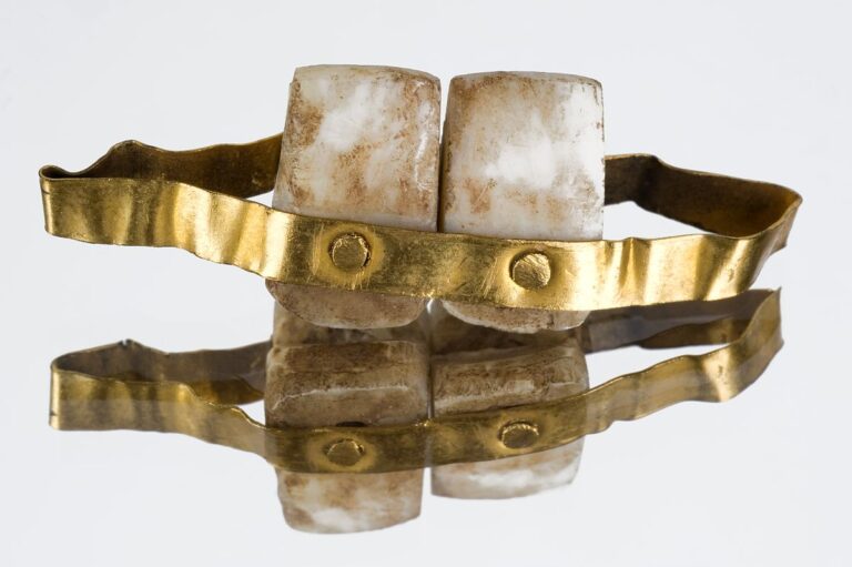 Kopie etruské zubní protézy. FOTO: Wellcome Collection / Creative Commons / CC BY 4.0